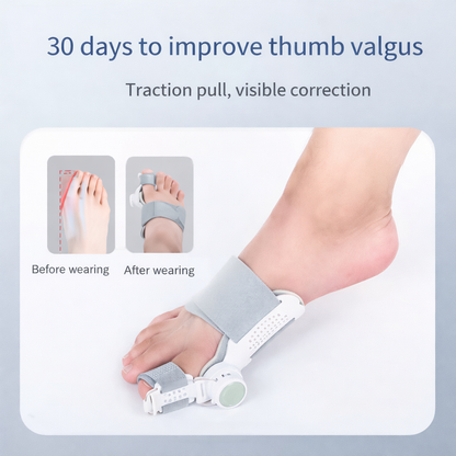 FamousLuxe™ Bunion Corrector