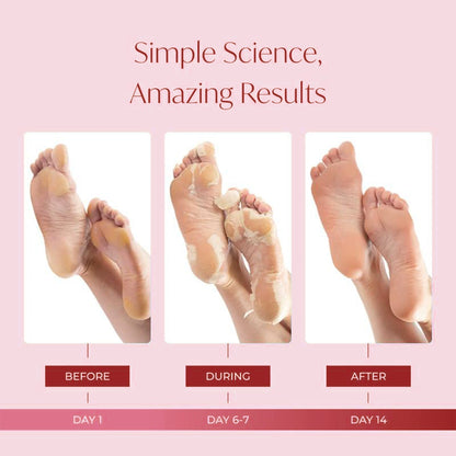 Peachy Soft Foot Peel Mask