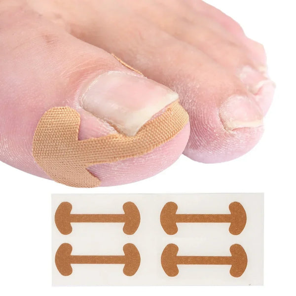 Gentle Toe Pain Relief Stickers