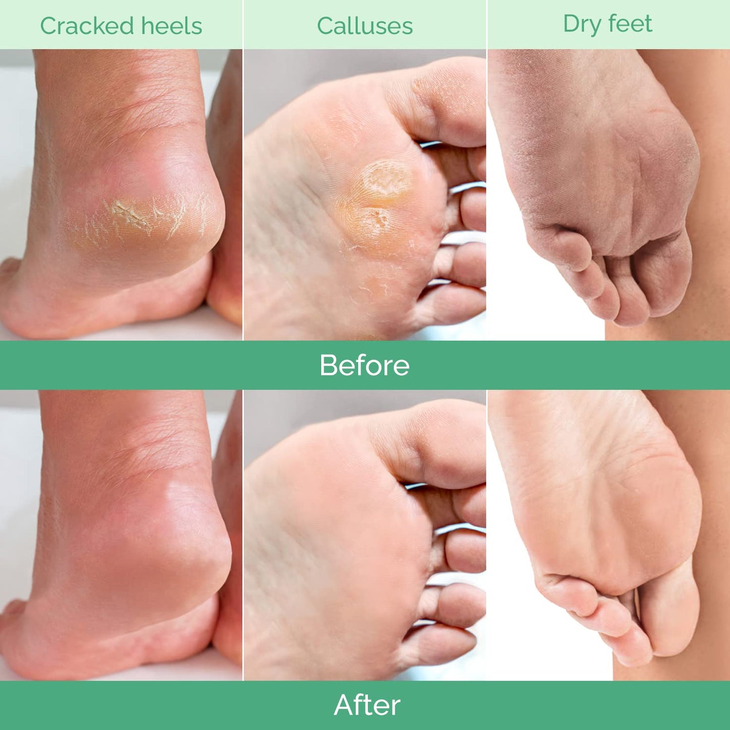 Peachy Soft Foot Peel Mask