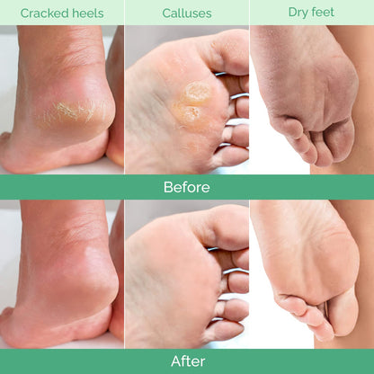 Peachy Soft Foot Peel Mask