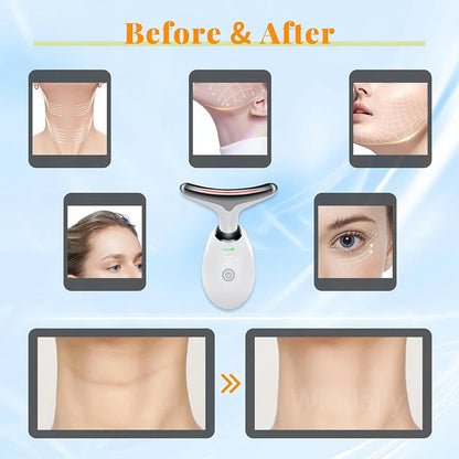 Youthful Glow Face Massager