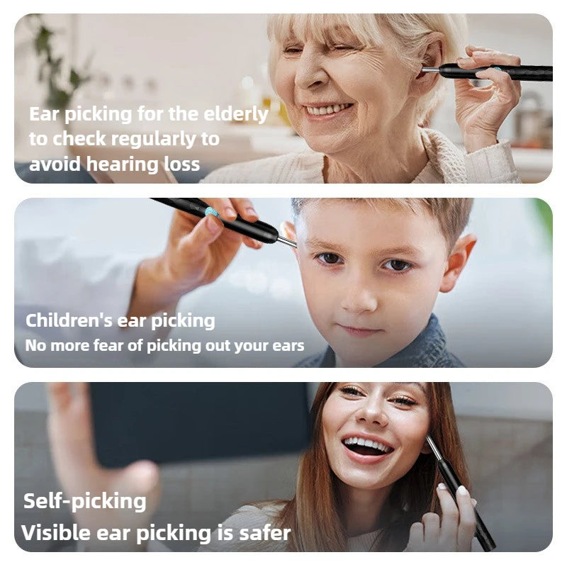 Famous Luxe™ ClearView Pro Ear Camera