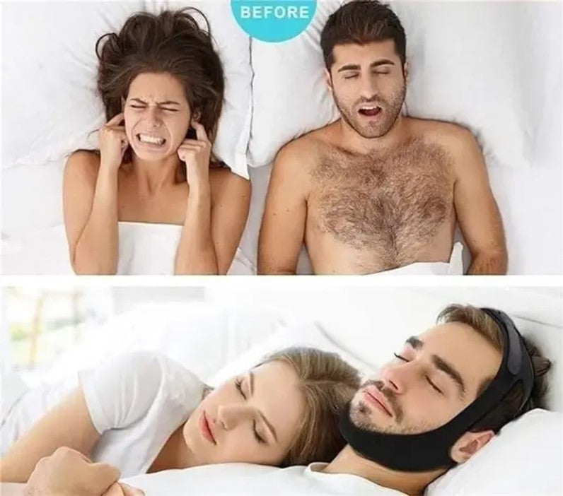 AirFlow Snore Strap
